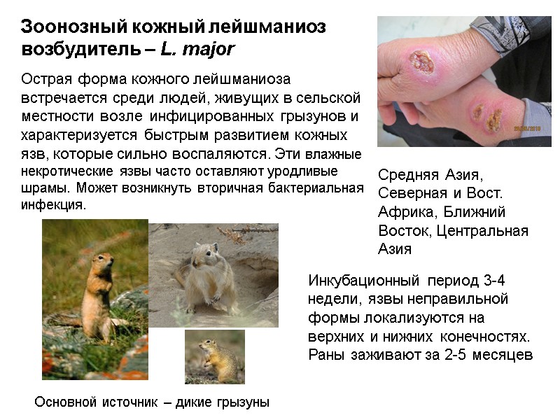 Зоонозный кожный лейшманиоз возбудитель – L. major  Острая форма кожного лейшманиоза встречается среди